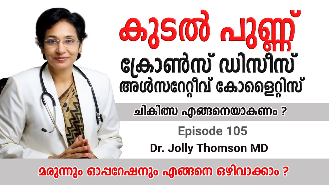 കുടൽ പുണ്ണ് - ക്രോൺസ് ഡിസീസ് - അൾസറേറ്റീവ് കോളൈറ്റിസ് || Crohns disease IBD, IBS || EP 105