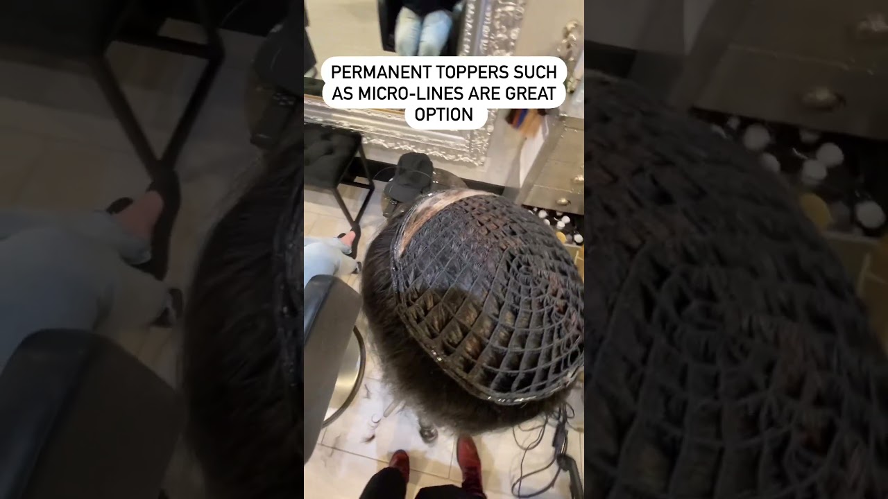 Wig vs MicroLines Topper