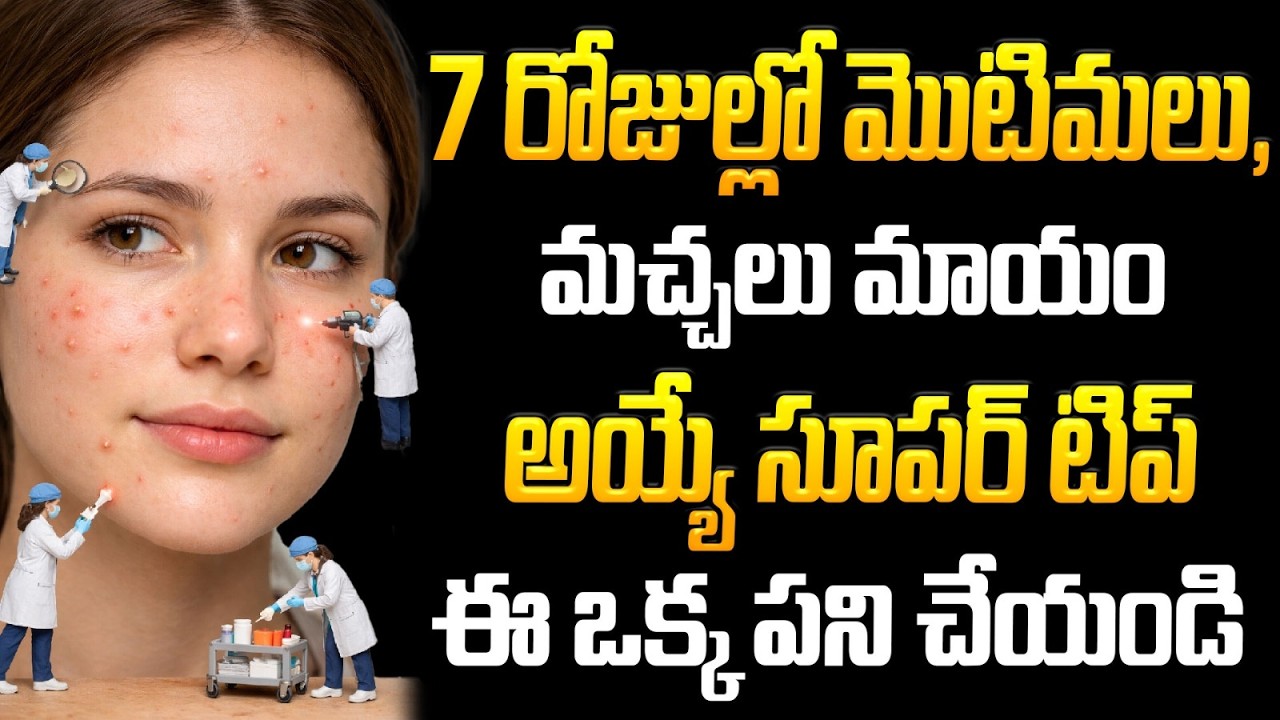 1 వారం లోనే క్లియర్ స్కిన్ కావాలా? ఈ టిప్ మిస్ అవ్వకండి! | Clear Skin in Just 7 Days? | ManamTV