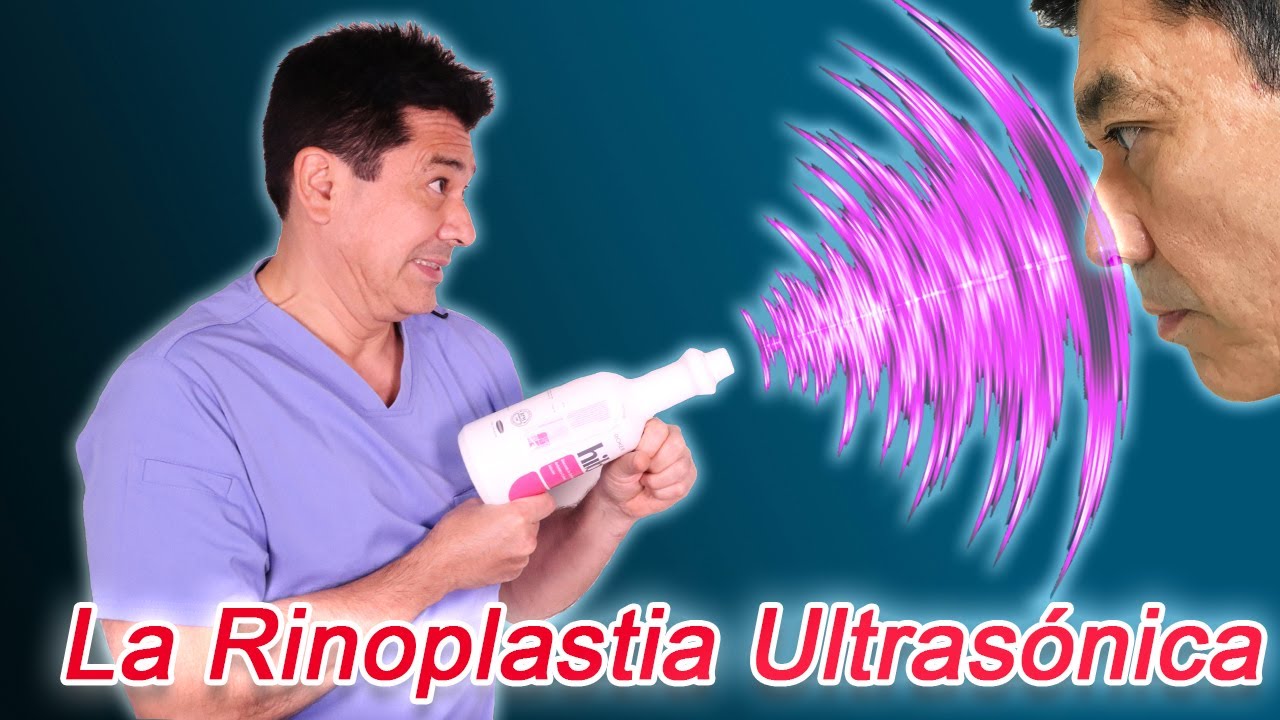 5 Puntos Claves Sobre La Rinoplastía Ultrasónica
