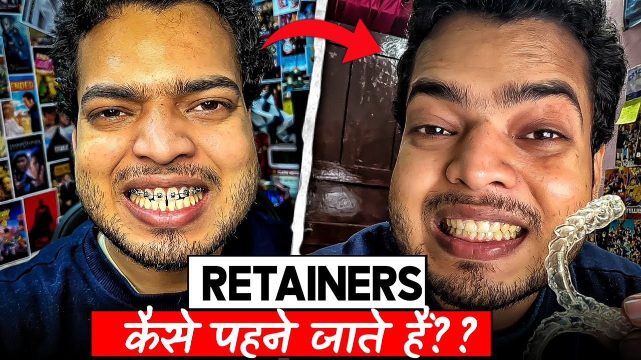 How To Wear Retainers | Retainers कैसे पहने जाते हैं?#braces #retainers 