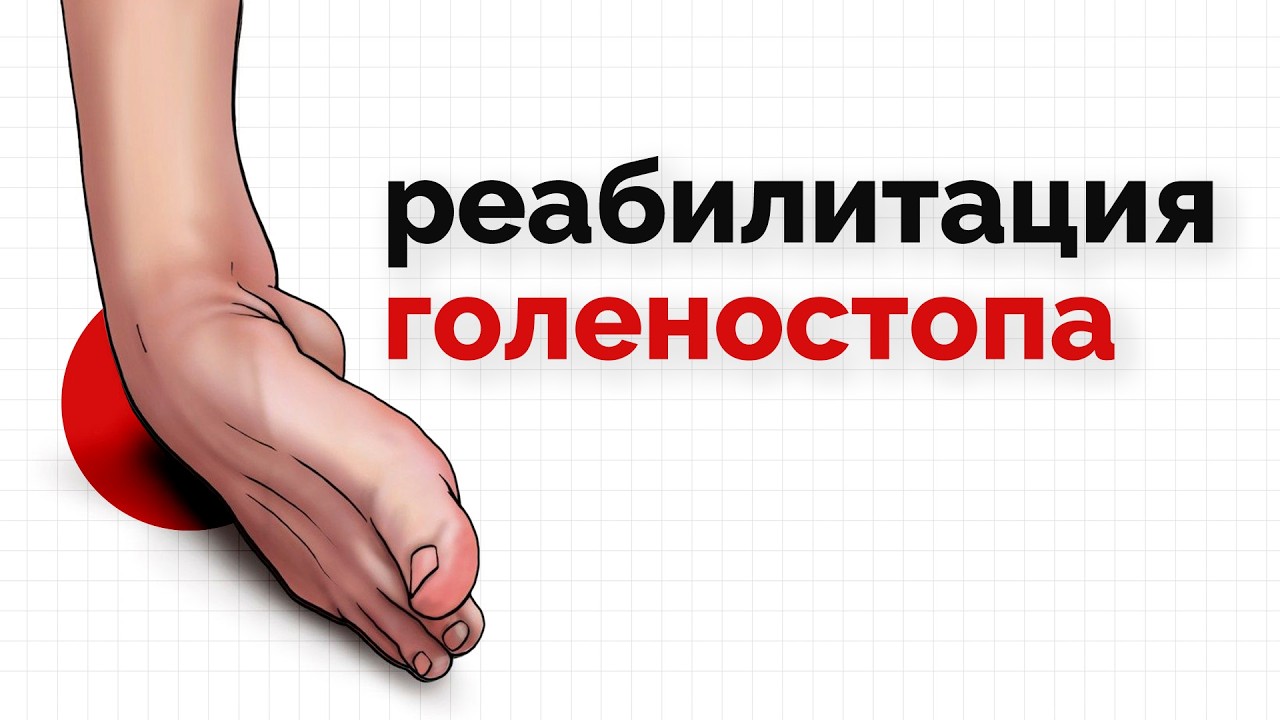 Подворот голеностопа - полная программа реабилитации