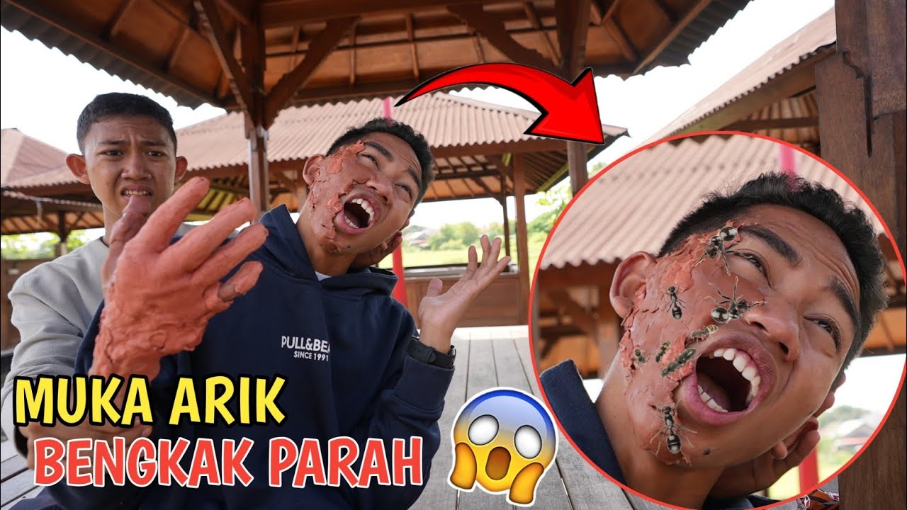 KASIHAN ARIK😭BAD4NNYA DIGIG1T SEMUT BULDOG SEMUT YG PALING BERBAH4YA?? | Mikael TubeHD