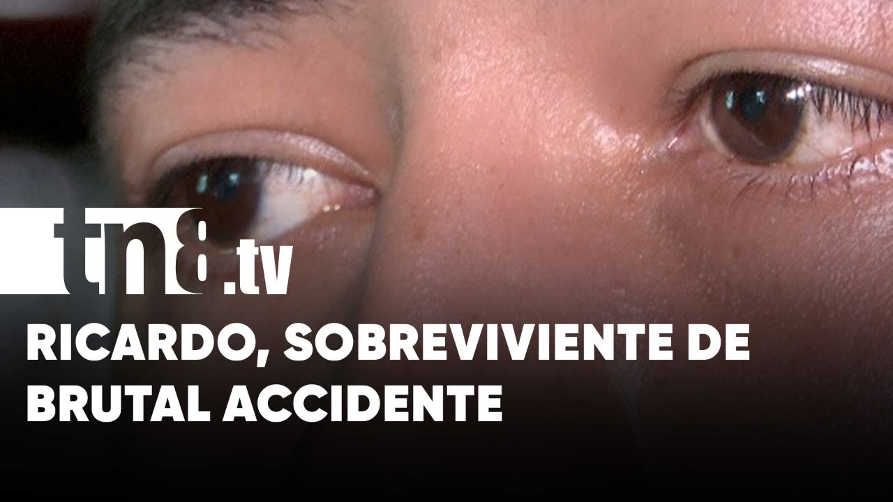 &iexcl;Sobreviv&iacute;!: La historia de Ricardo, quien sufri&oacute; atroz accidente en Managua - Nicaragua