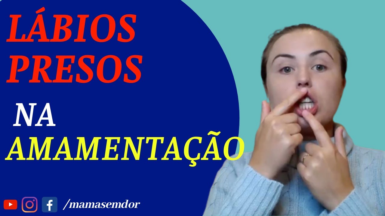 FREIO do LÁBIO CURTO na AMAMENTAÇÃO. Saiba IDENTIFICAR!