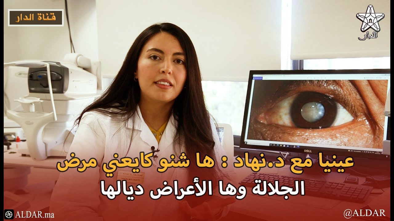 عينيا مع د.نهاد : ها شنو كايعني مرض الجلالة وها الأعراض ديالها