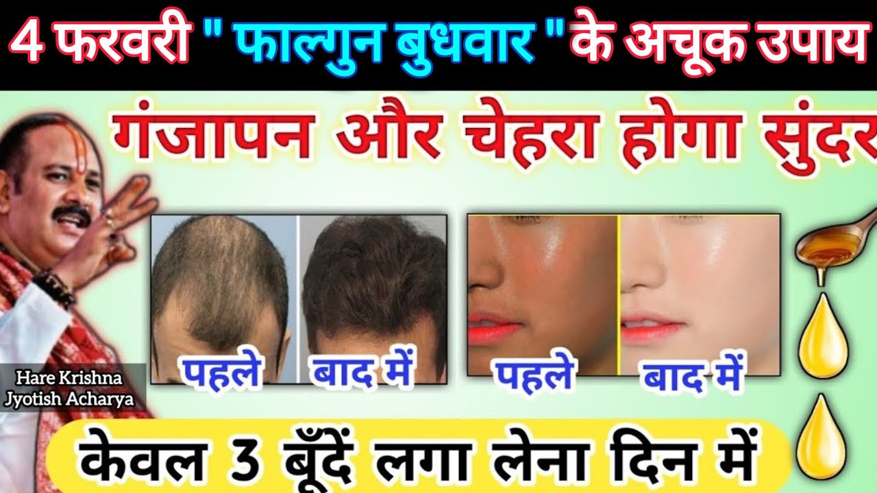 4 फरवरी फाल्गुन बुधवार अचूक उपाय | गंजापन और चेहरा होगा सुंदर |