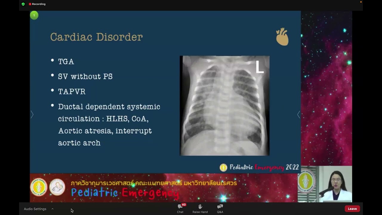 PED NU 2565 : Pulmonary hypertension management in pediatrics