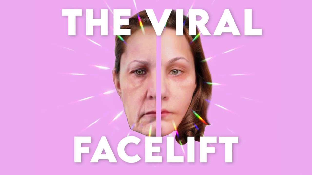 Michelle Wood’s Viral Facelift and Why I Chose Dra Maribel Belmontes in Guadalajara at 48 Years Old