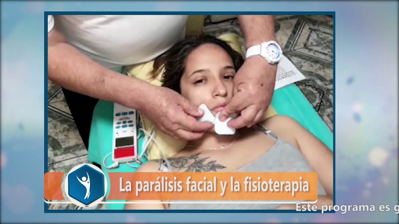 Sentirse Bien 09: La parálisis facial y la fisioterapia