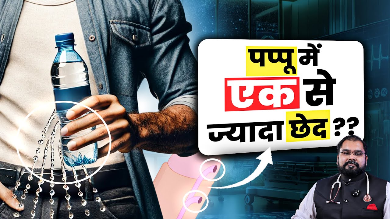 दो छेड़ वाला लिंग : Hypospadias