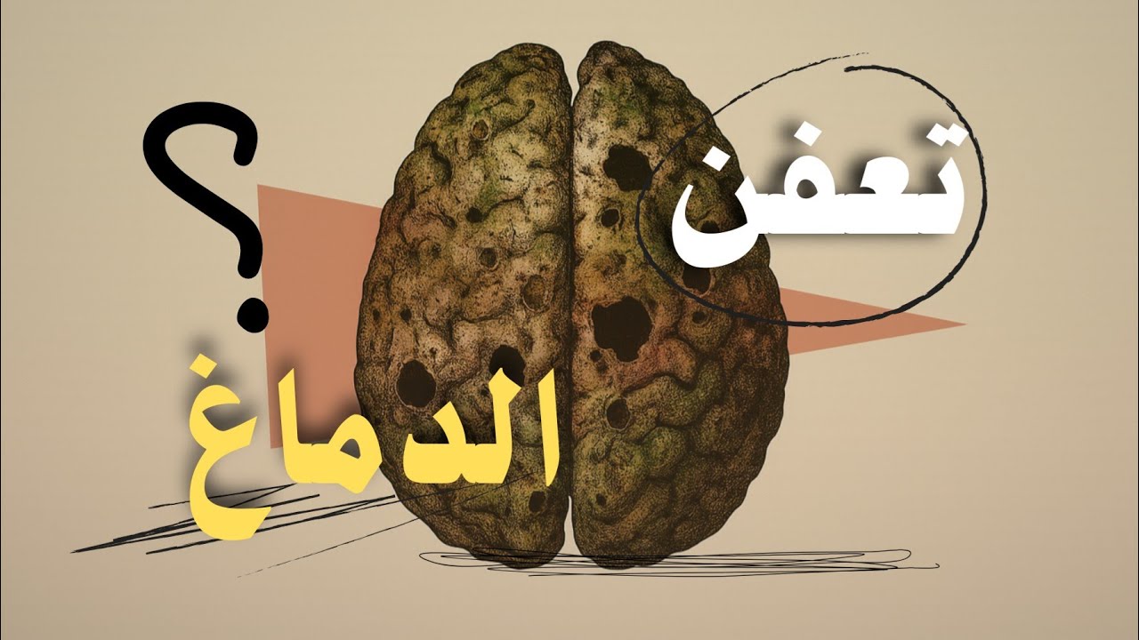 تعفّن الدماغ.. الحل في دقيقة!
