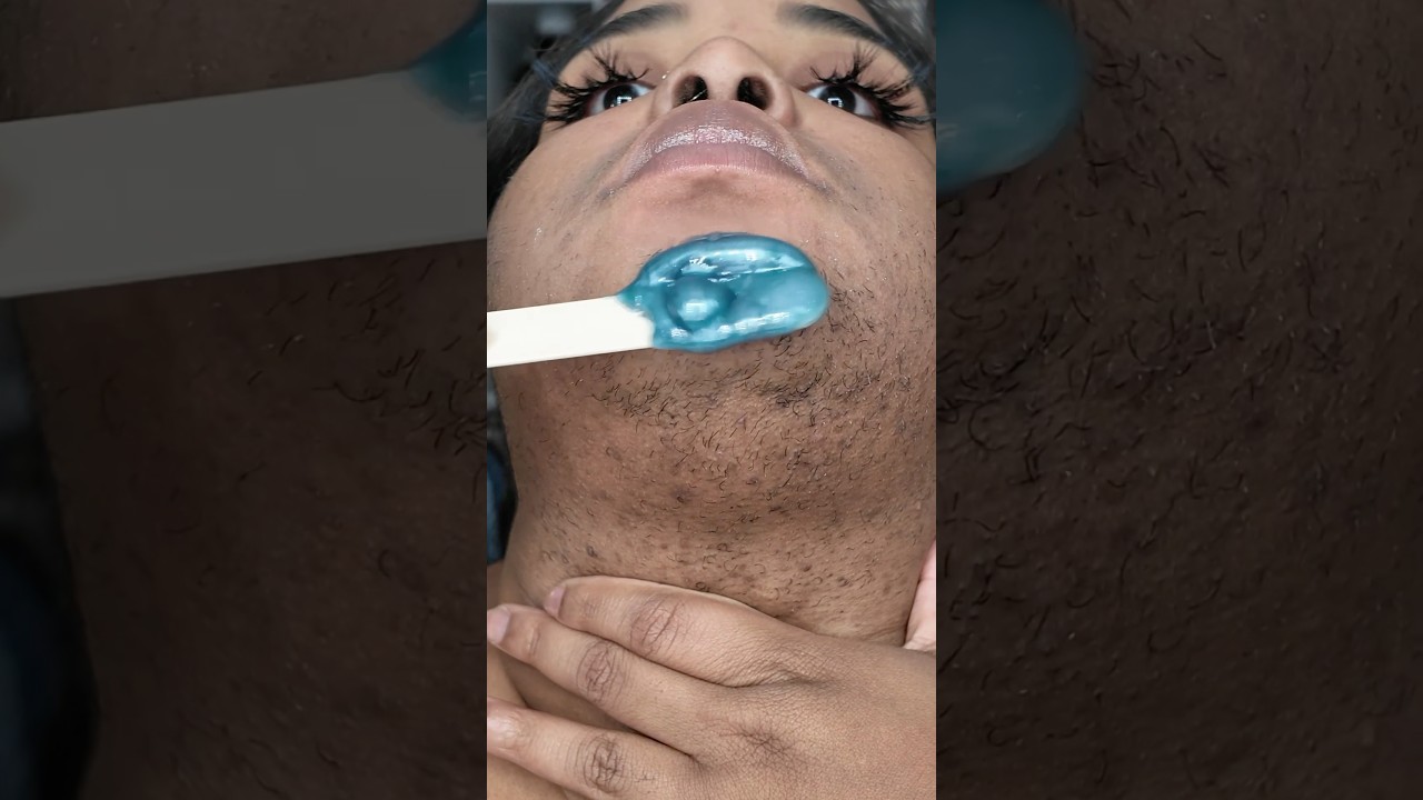 09.08.24 full face wax ft. @tresswellness  #facewax #hardwax #pcos #hirsutism #waxtutorial