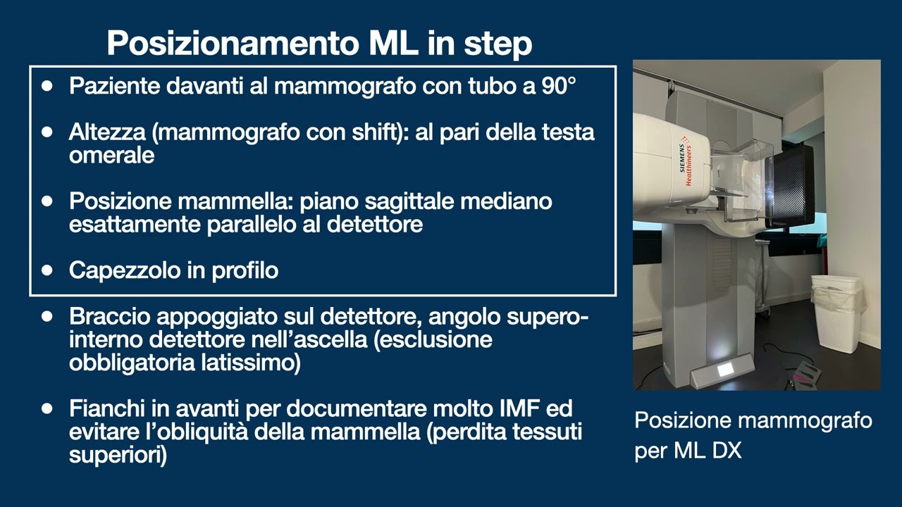 Proiezione MedioLaterale (ML)