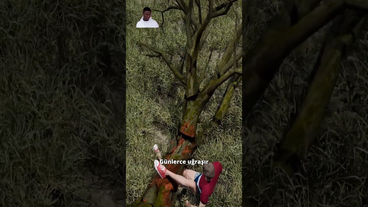 Kendi Bacağını Kesen Adam