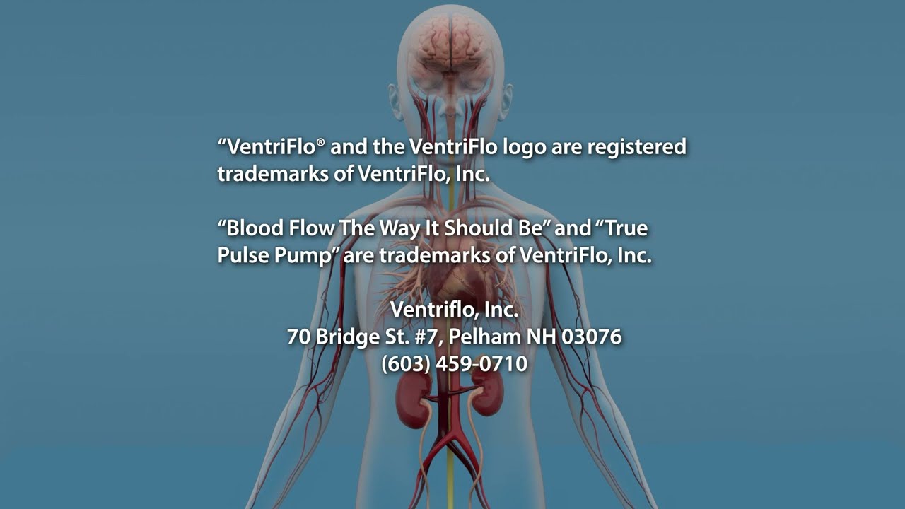 Pulsatile Flow Animation — VentriFlo® True Pulse Pumps™ — Blood Flow The Way It Should Be™