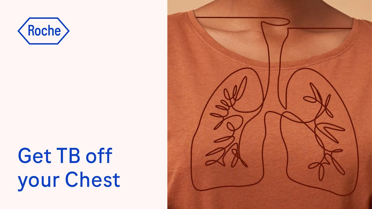 Get TB off your chest