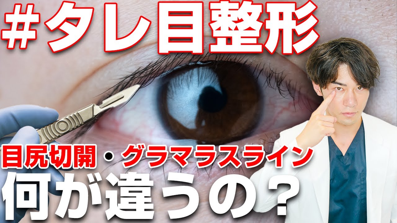 【タレ目整形】目尻切開とグラマラスラインって何が違うの？
