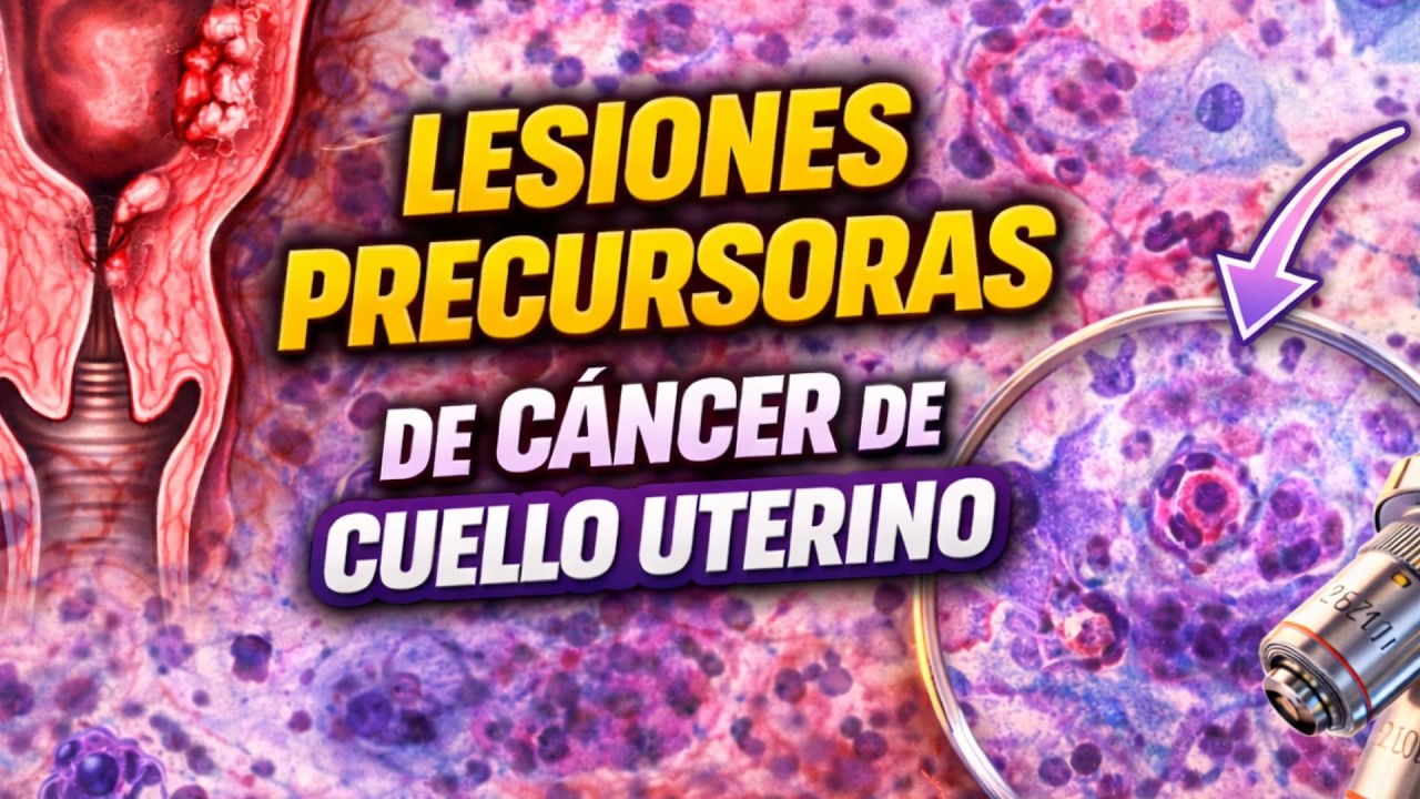Lesiones precursoras de cáncer de cuello uterino