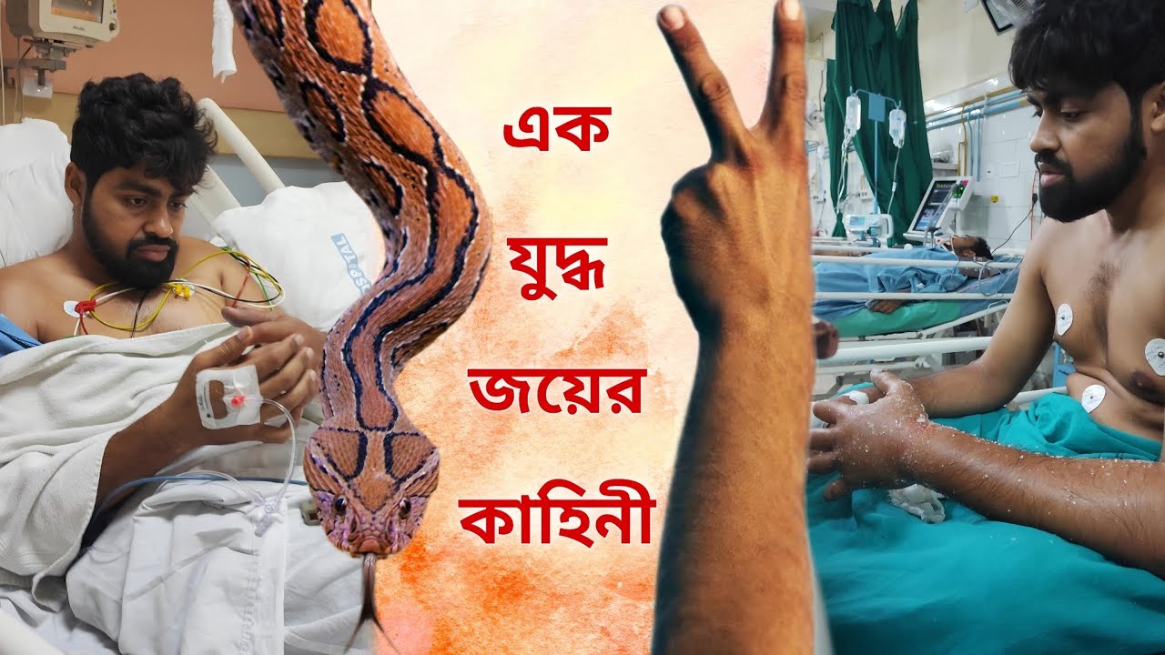 চন্দ্রবোড়ার ছোবল খে*য়ে কীভাবে বেঁ*চে ফিরলো শাশ্বত? তার মুখ থেকেই শুনুন | Russell's Viper B*ite