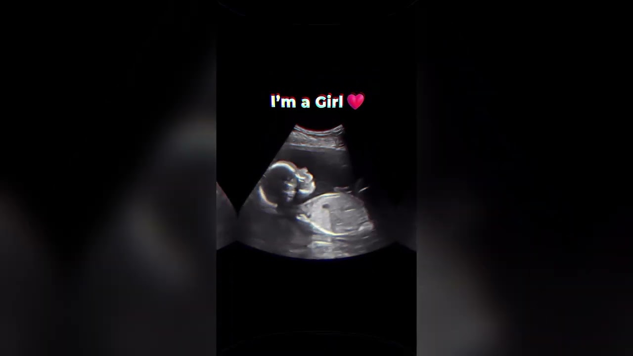 AI Gender Reveal app in the world, NubX #pregnancy  #babygender #genderexpression #pregnant