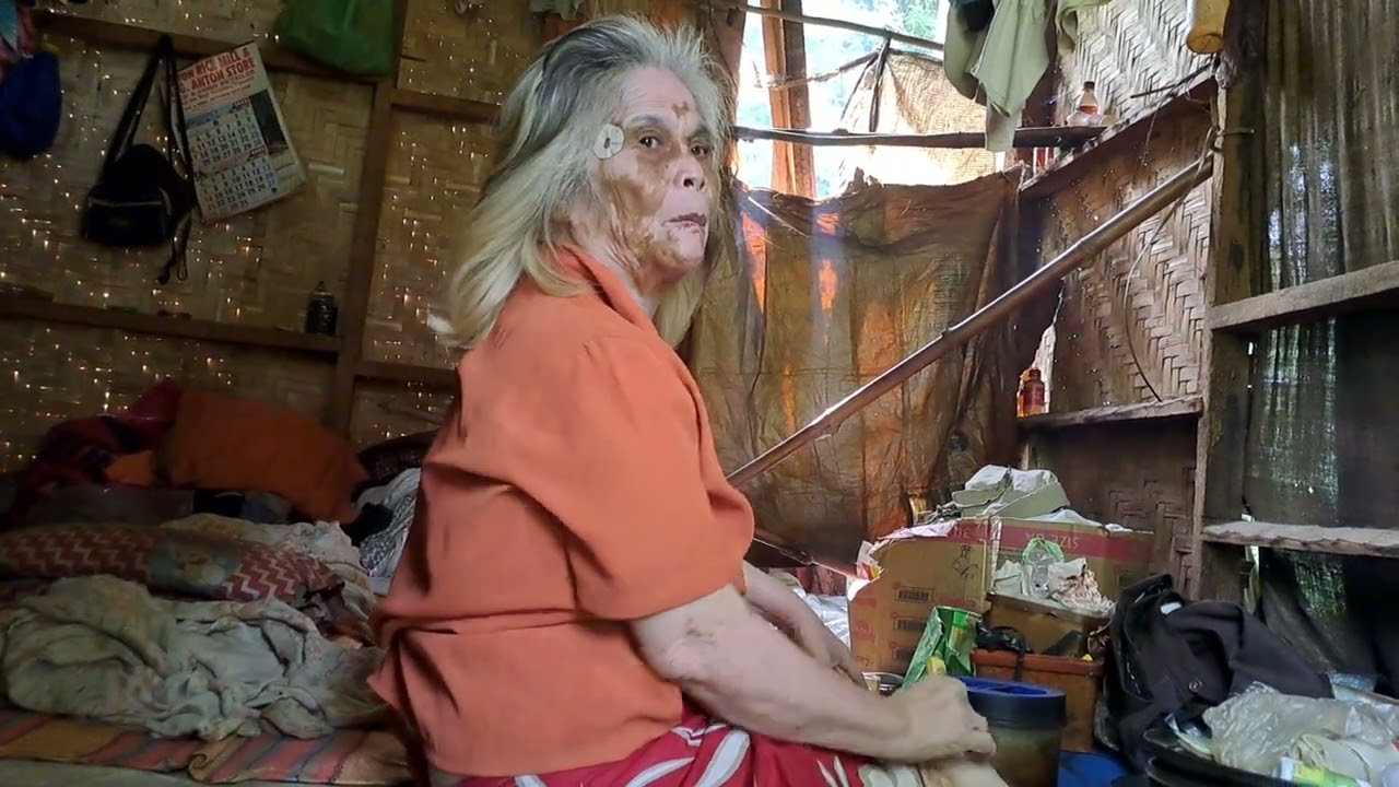 Charity Blog... Tabang para ni Lola...#kalingaprab #kinglucks #pugongbyahero#loladamiana same cases