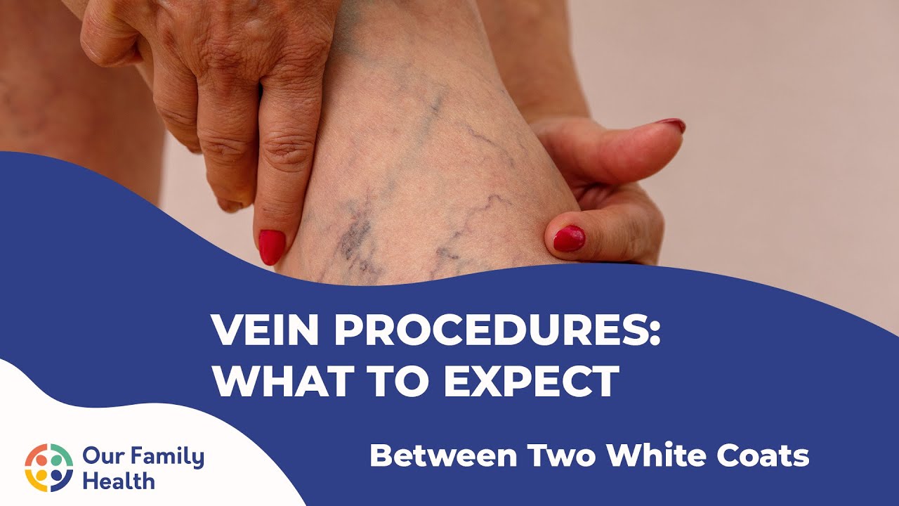 Vein Procedures: What to Expect