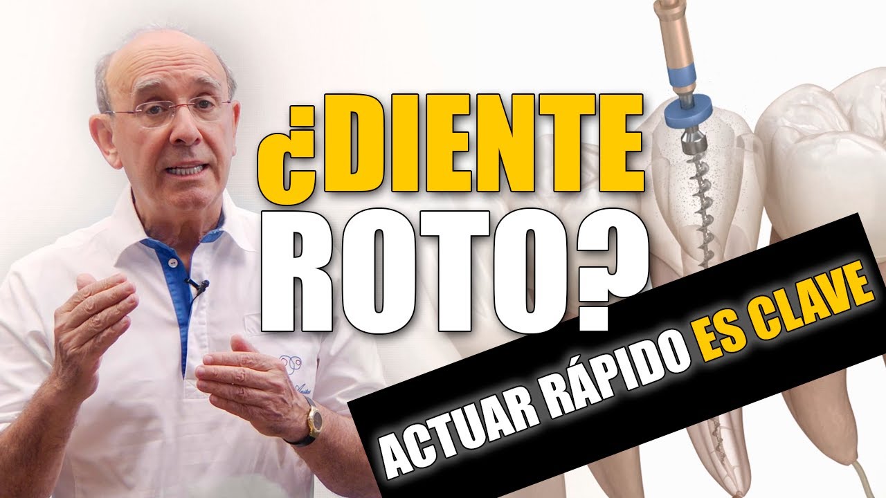 Traumatismo dental en la infancia. ¿Cómo actuar ante un diente roto? 🦷😫
