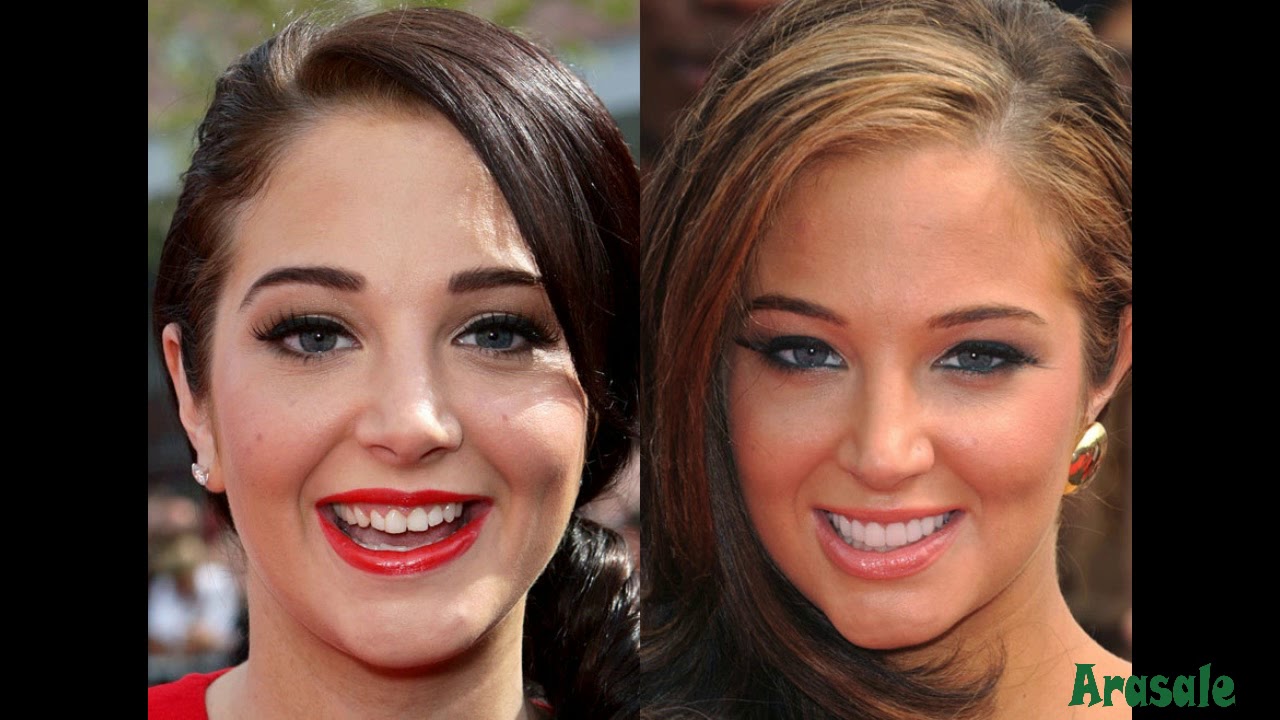 Celebrity teeth before and after