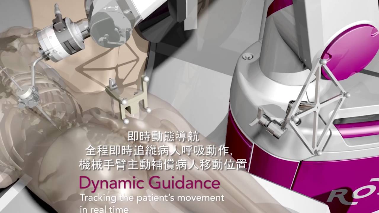ROSA Spine 3D Video | Unison Healthcare Group友信醫療集團