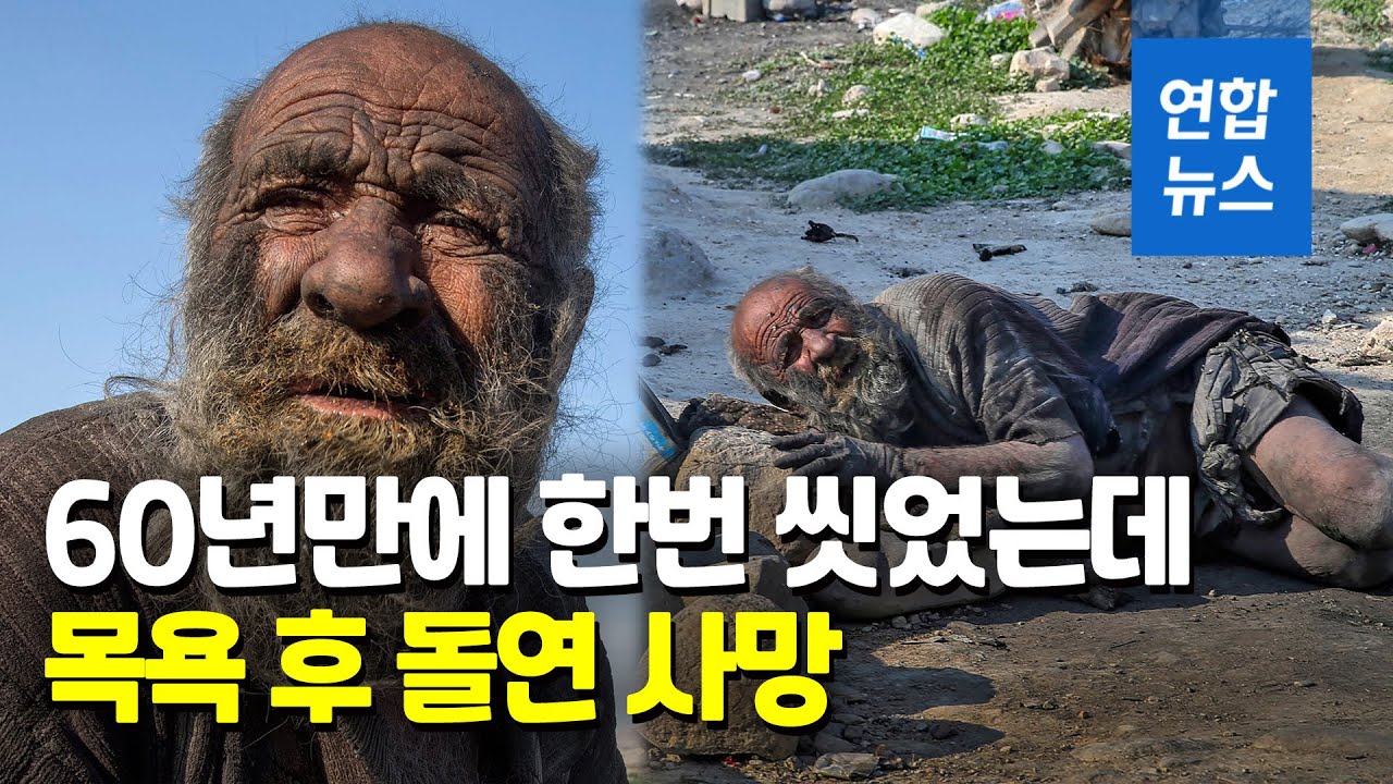 60년 안씻다 처음 씻었는데…'가장 더러운 사나이' 목욕 후 사망 / 연합뉴스 (Yonhapnews)