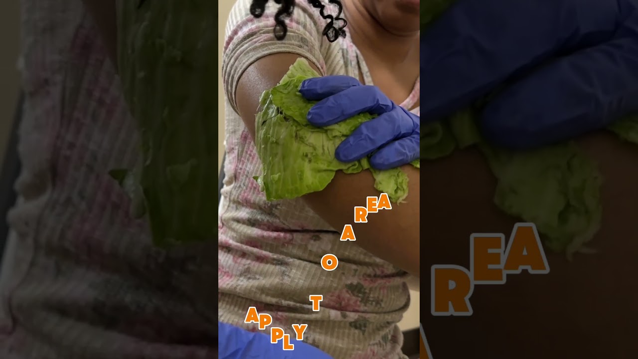 How to Make a Cabbage Poultice - LC class