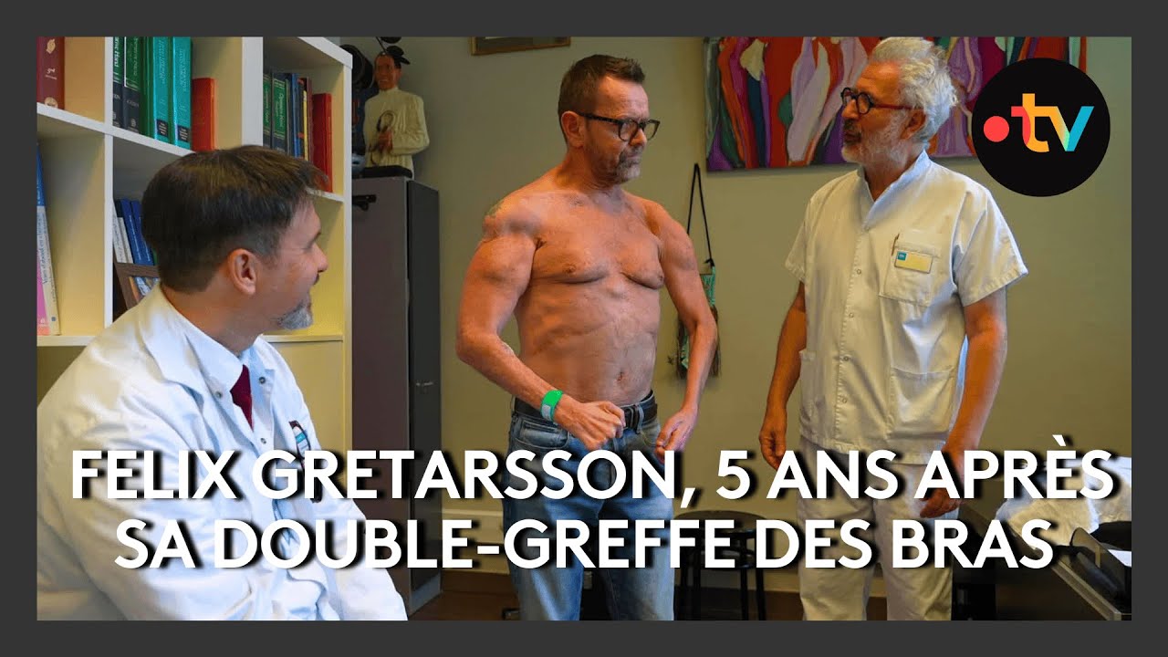 Felix Gretarsson, 5 ans après sa double-greffe des bras