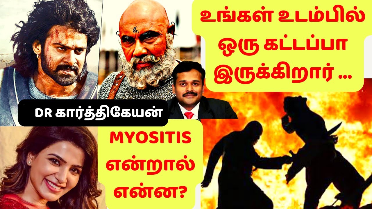 Auto immune வியாதி என்றால் என்ன? எப்படி வருகிறது? என்ன மருந்துகள் குணப்படுத்தும்?