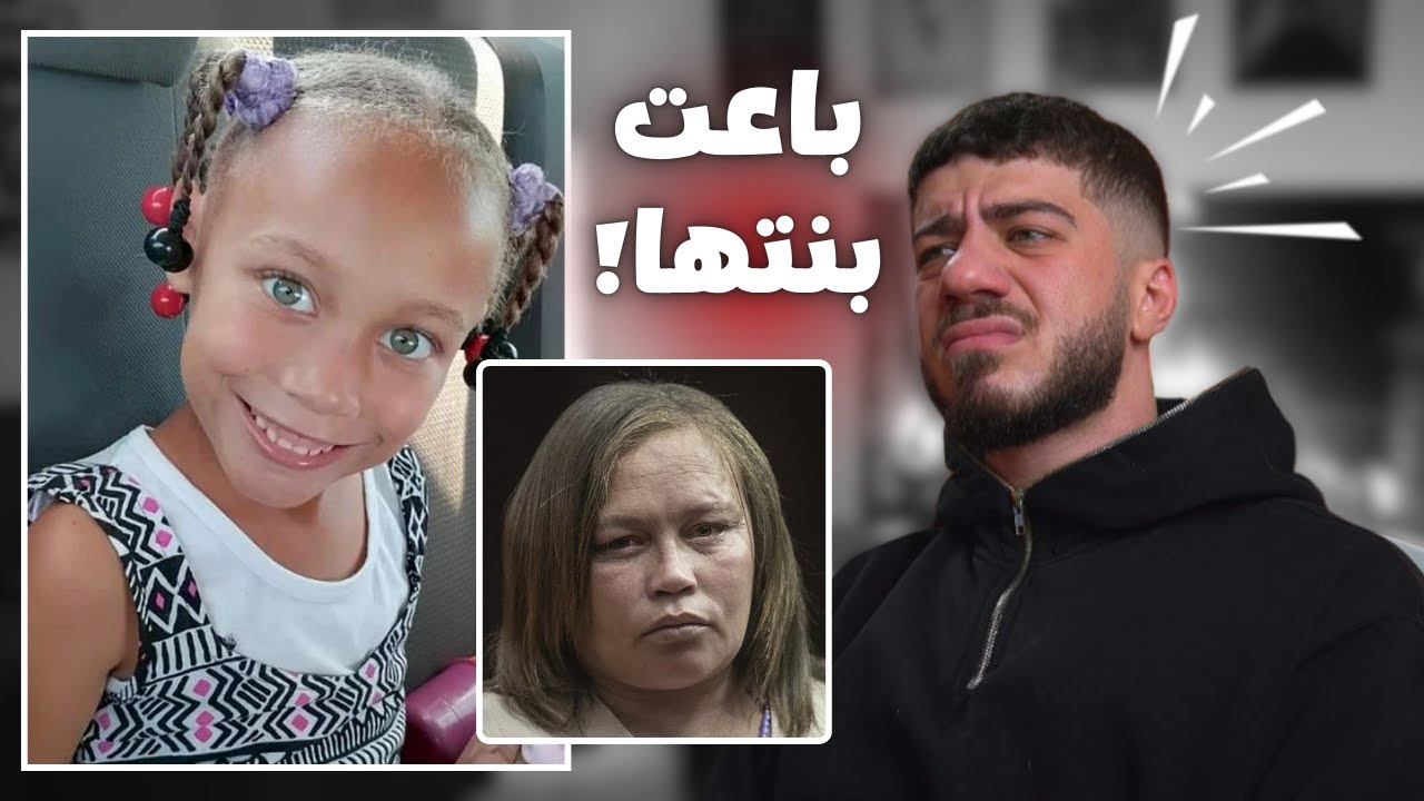 ام باعت عيون و جلد بنتها