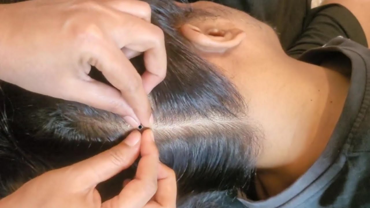 Scalp Checking ASMR, Relaxing ASMR For Instant Sleep ✨