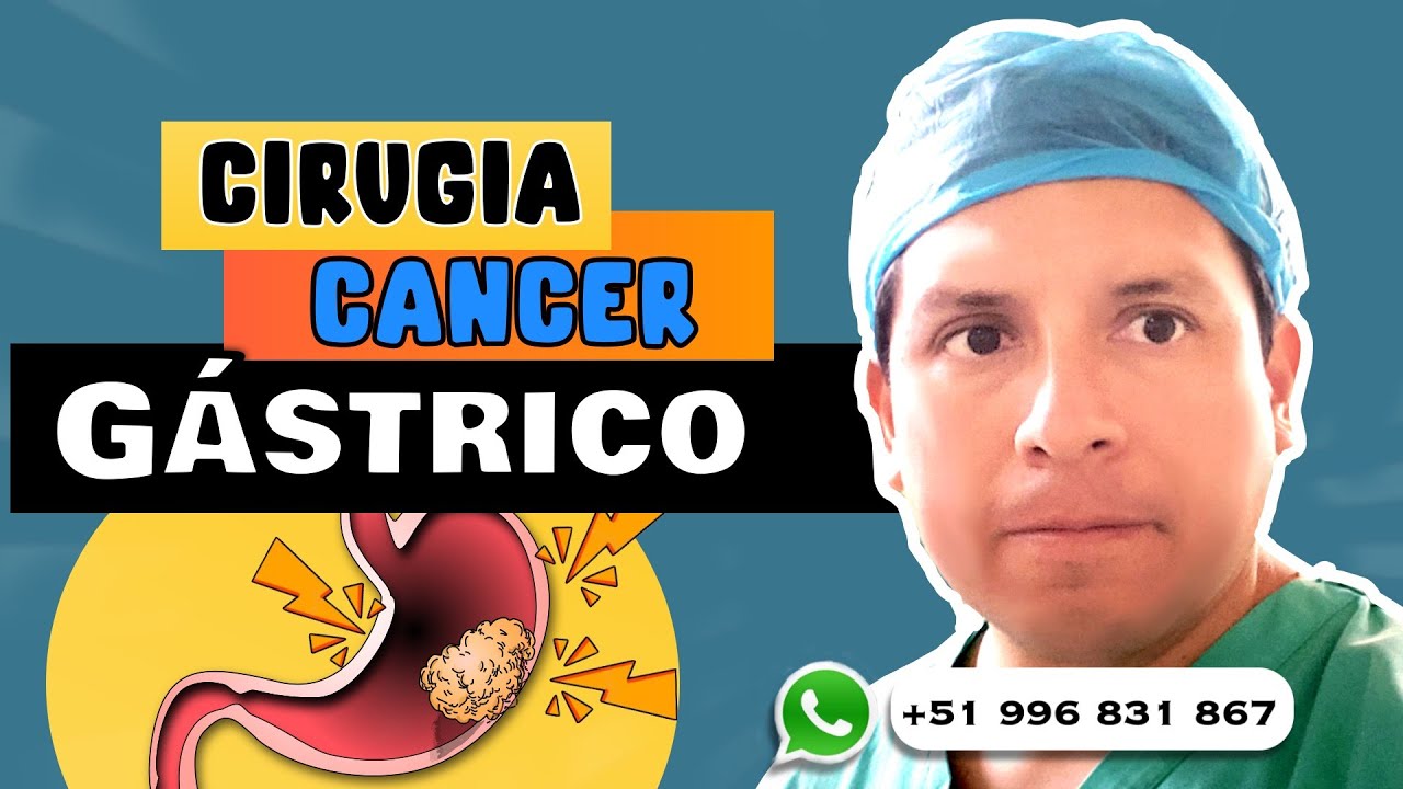 CIRUGÍA DEL CÁNCER DE ESTÓMAGO ¿QUÉ ES LA GASTRECTOMÍA?
