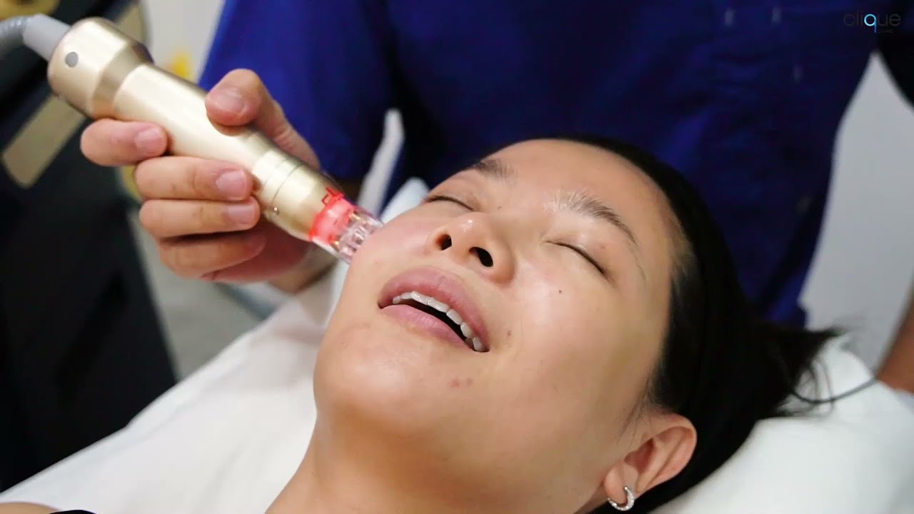 Emily Lim带你一同体验 Sylfim X 疗程| Sylfirm X Malaysia | Clique Clinic