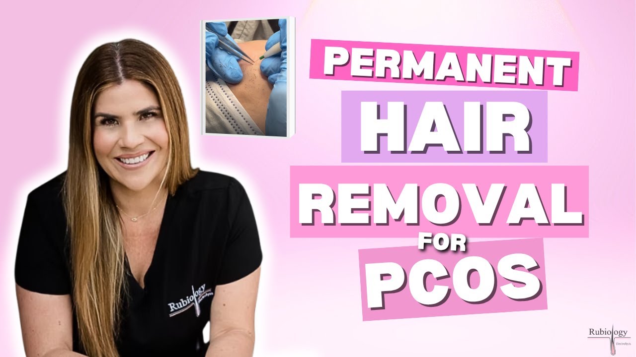 She Tried Laser for PCOS Facial Hair—Then Found Electrolysis | Real Results with Rubiology
