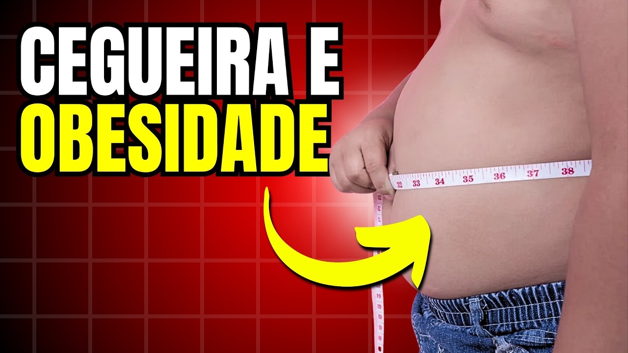 Síndrome de Bardet Biedl - Cegueira Com Obesidade