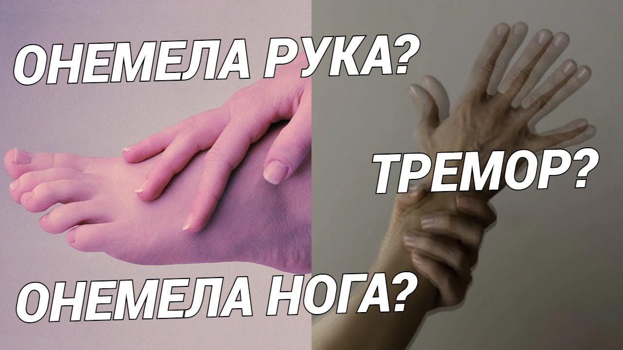 Онемела рука? Онемела нога? Тремор в конечностях? Разбираем причины и лечим!