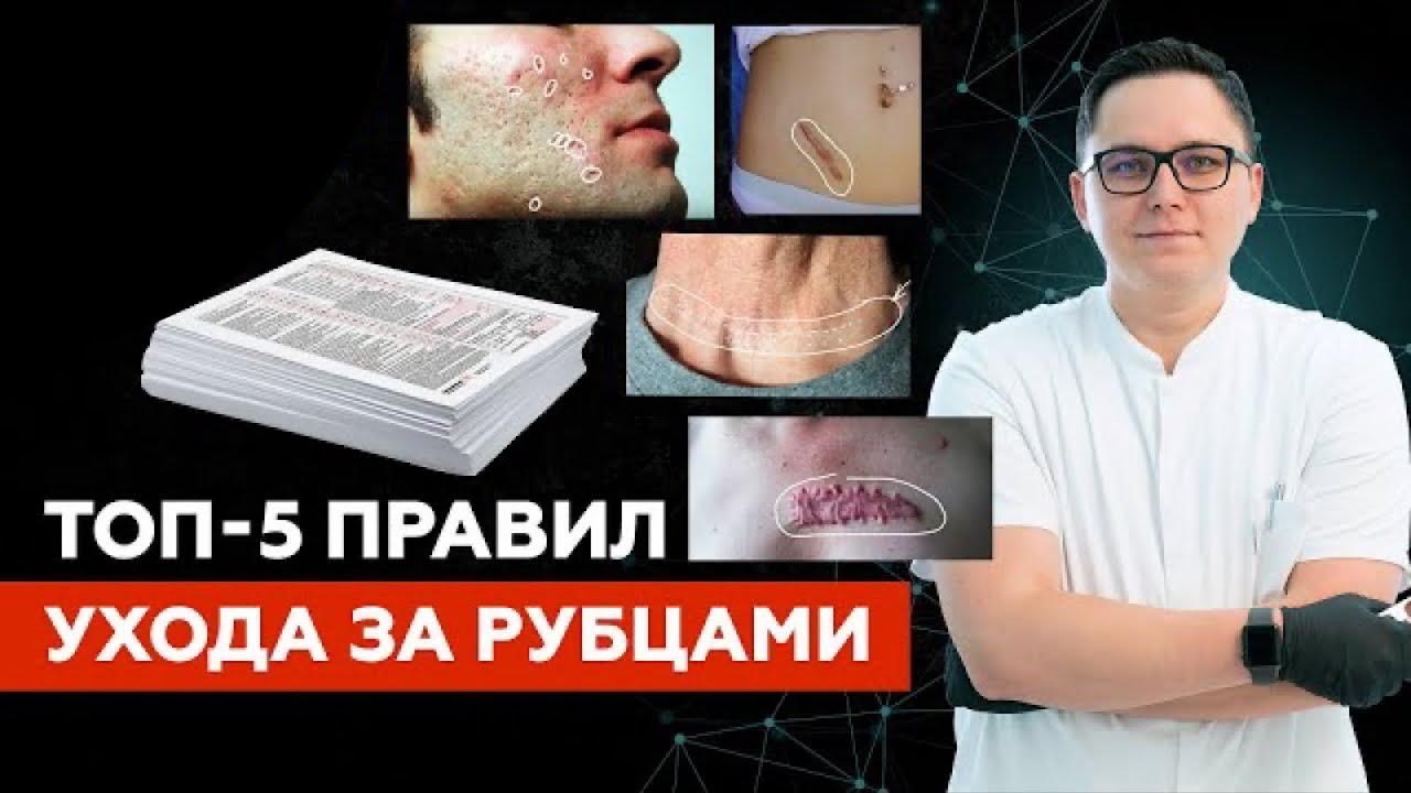 Как ухаживать за рубцами кожи?