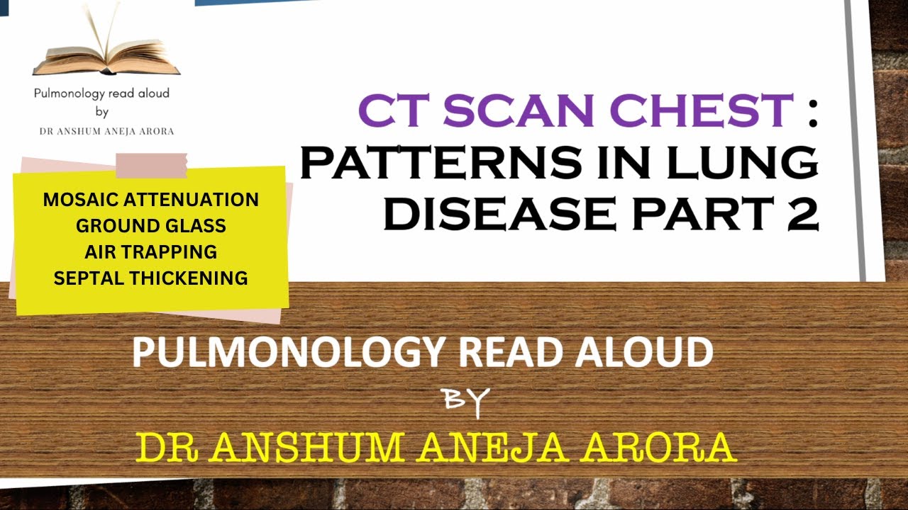 CT SCAN PATTERNS PART 2- MOSAIC,GROUND GLASS,AIR TRAPPING