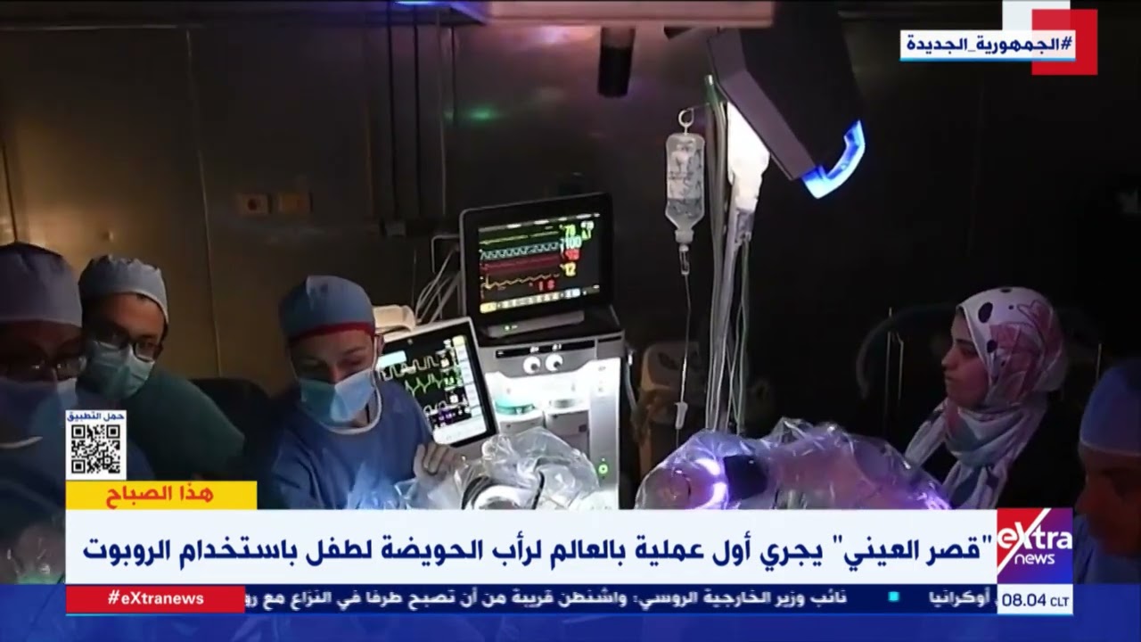 هذا الصباح| قصر العيني يجري أول عملية بالعالم لرأب الحويضة لطفل باستخدام الروبوت