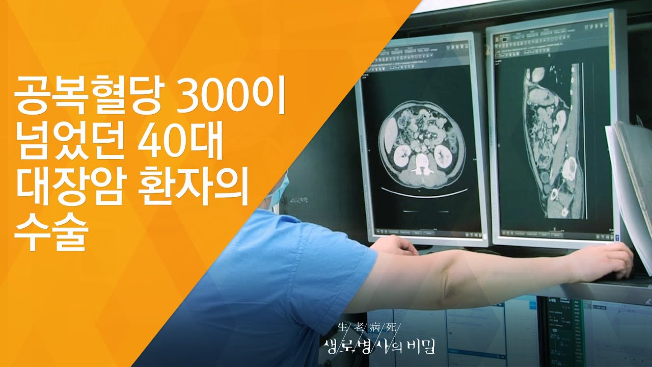 공복혈당 300이 넘었던 40대 대장암 환자의 수술 - (2017.6.14_624회 방송)_암을 부르는 당뇨병