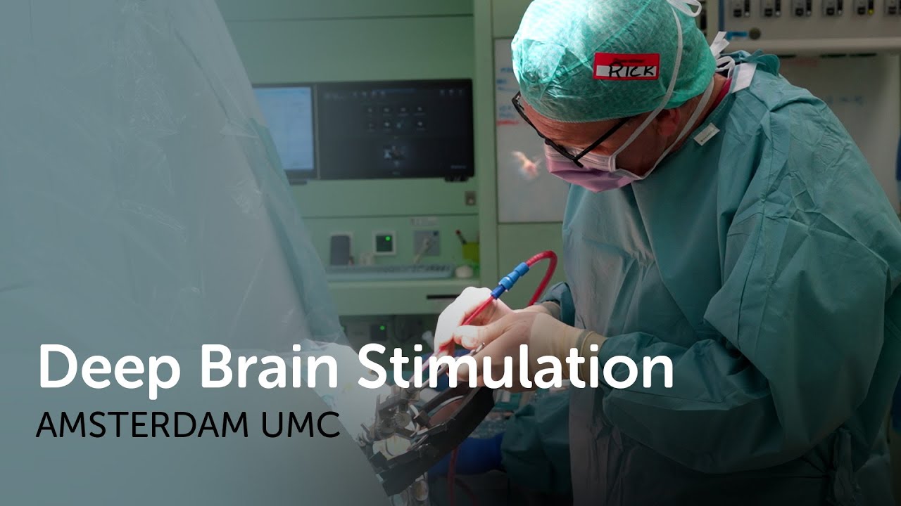 Deep Brain Stimulation: Hoe werkt het en wat doet het?
