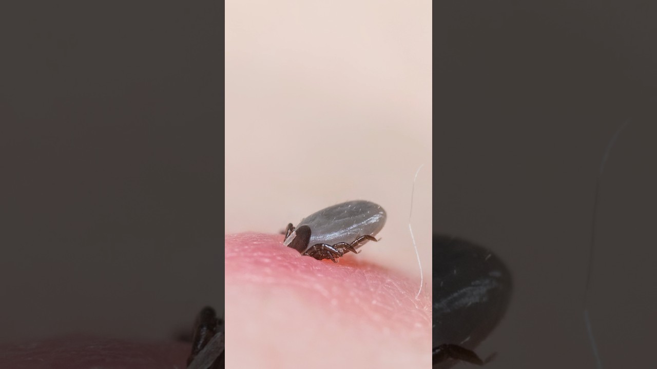 How to remove a tick