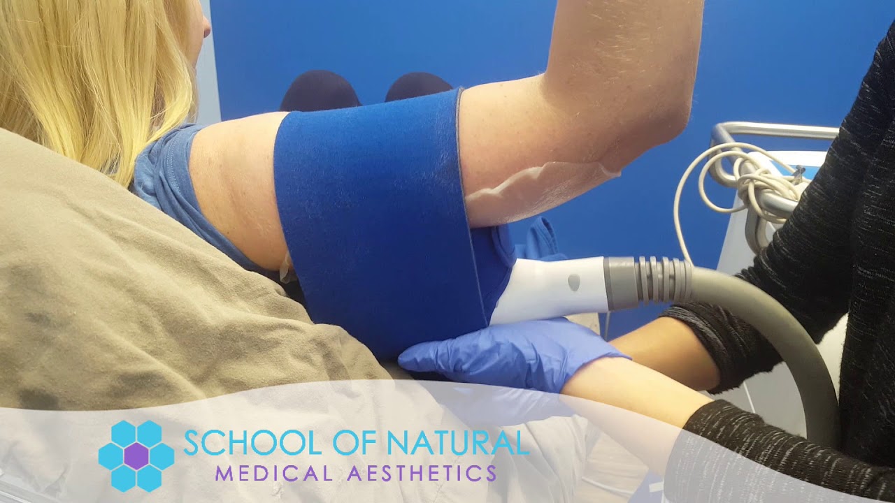 Coolsculpting Training for Medical Astheticians
