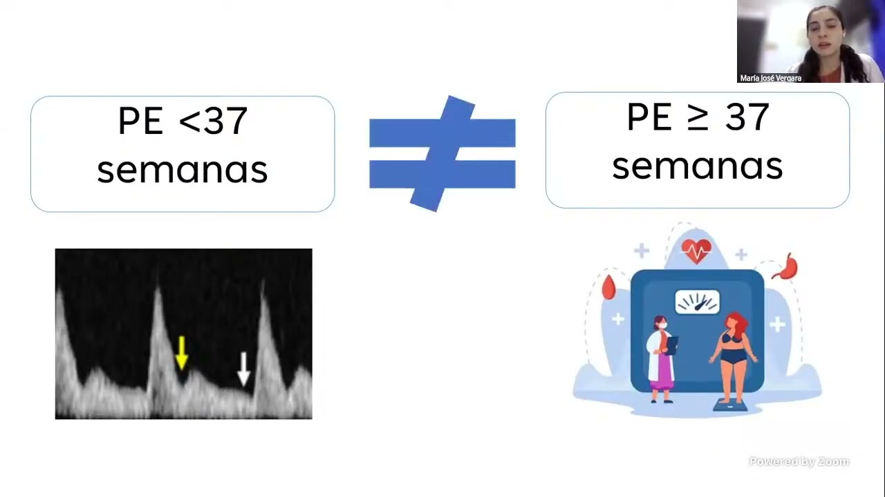 Estrategia de prevención de preeclamsia de término 