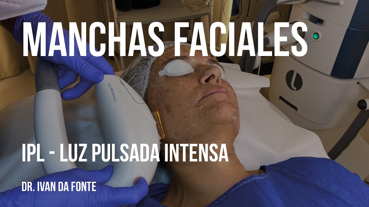 Fotorrejuvenecimiento facial con IPL